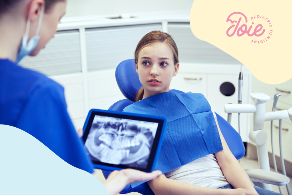Can You Reverse a Cavity in Kids?