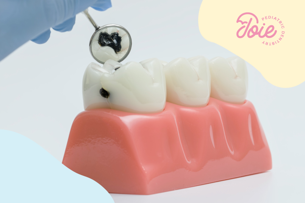 cavity